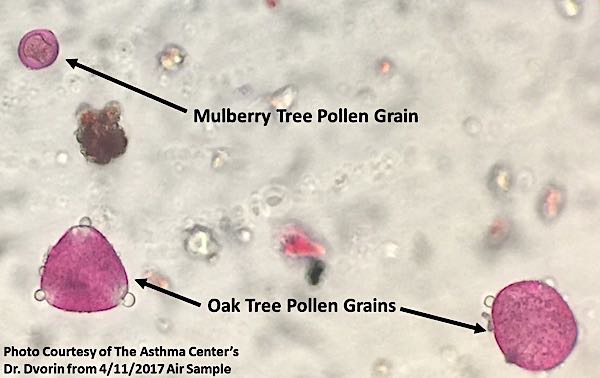 Tree Pollen Under A Microscope