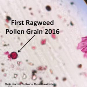 Ragweed first day 2016 microscope only