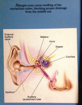 Ear Diagram for Ear Allergies