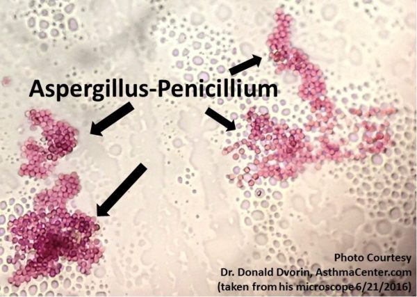 mold allergy and aspergillus - penicillium